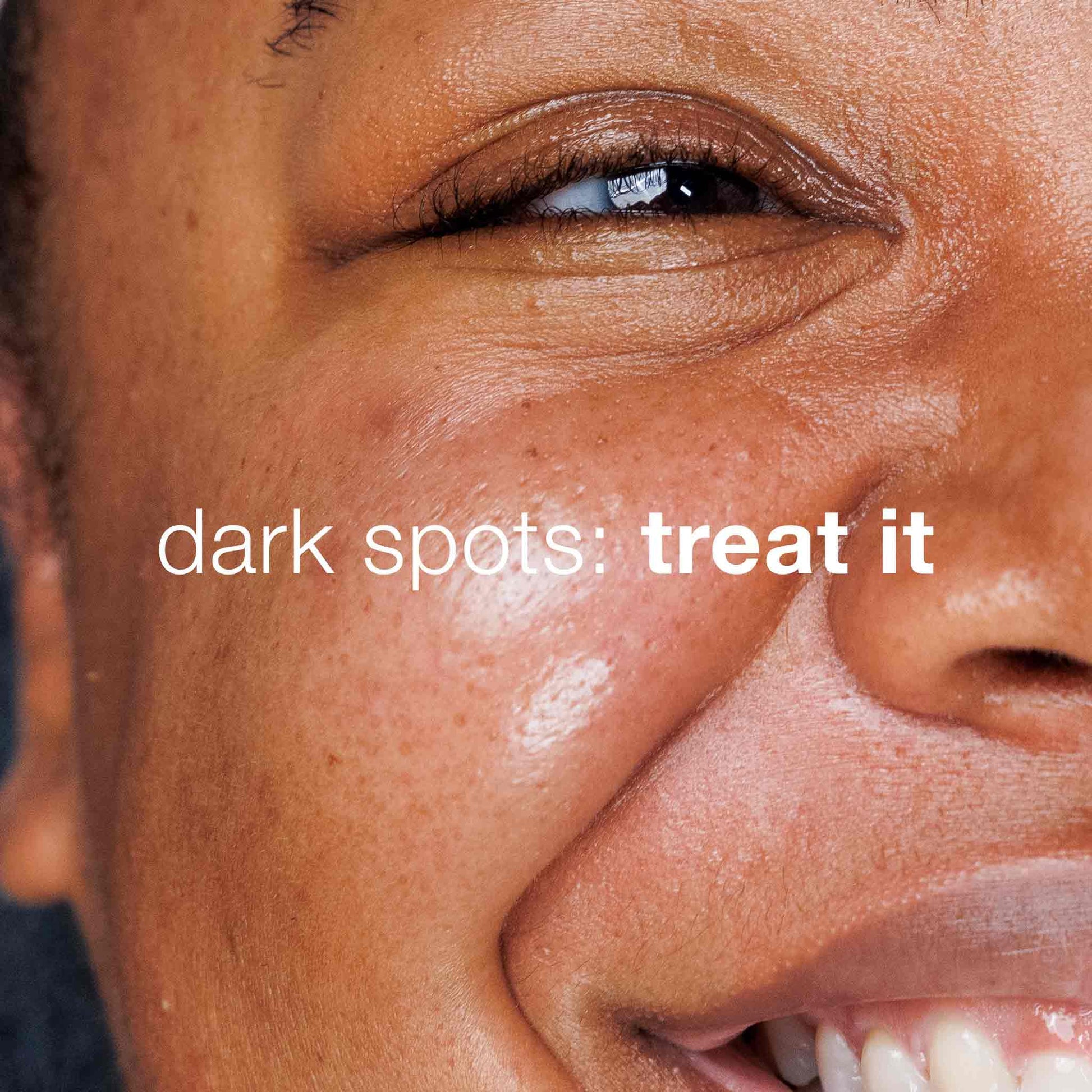 Dermalogica - Dark Spot Solutions Kit